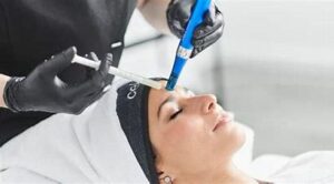 Mésoporation Calvados